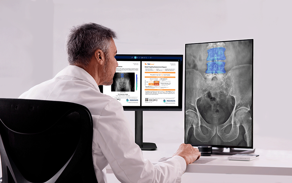 TBS Reveal* is designed to help close this gap by detecting fragility earlier, directly from routine X-rays.